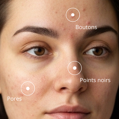 Coffret Éclat Pur - Routine Anti-imperfections
